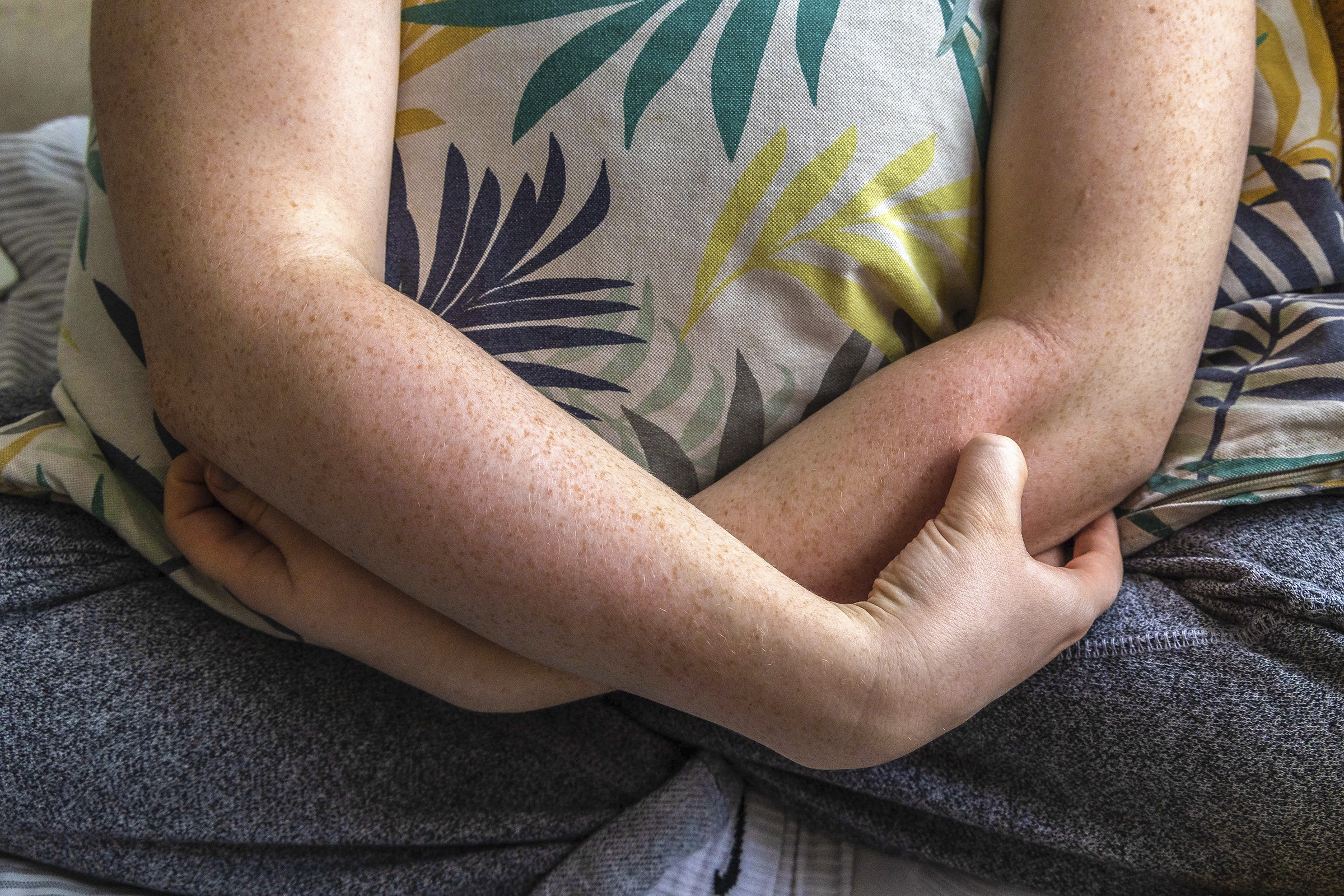 A woman's arms crossed, hugging a pillow, in a crossed legged position, pinching her own forearm as a way to cause self harm and feel something.